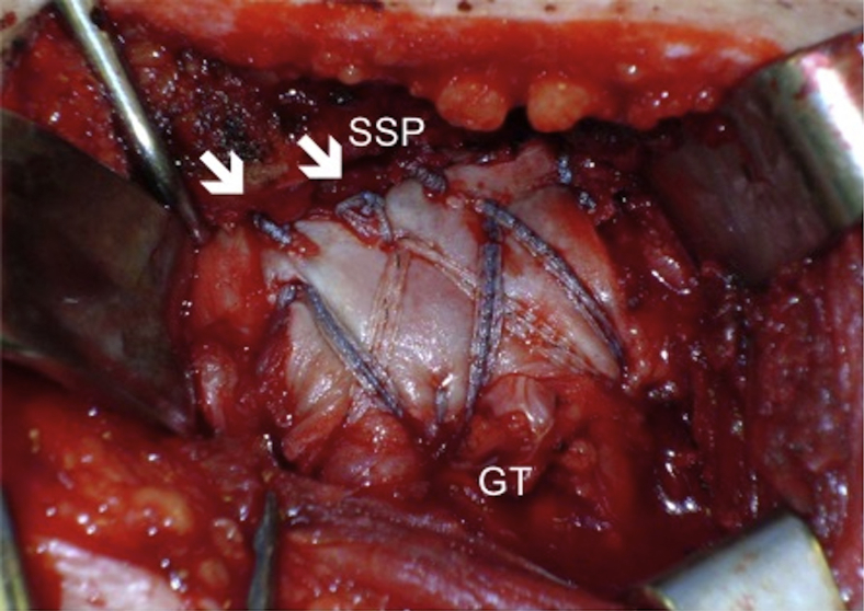 Fig 6