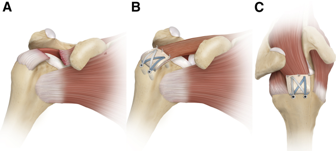 Fig 5