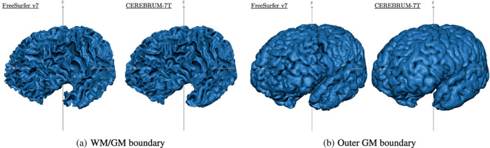 FIGURE 14