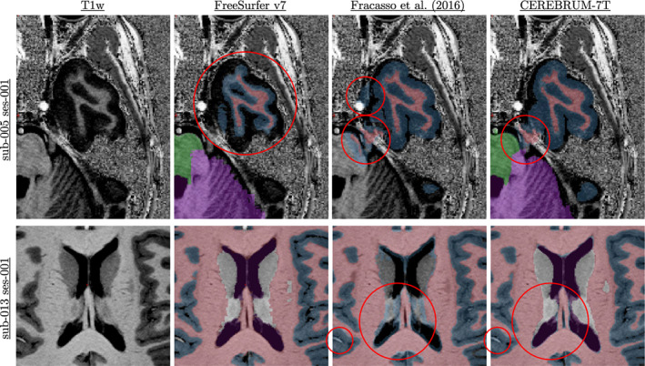 FIGURE 15