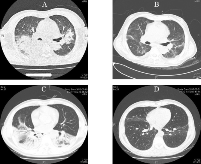 Fig. 2