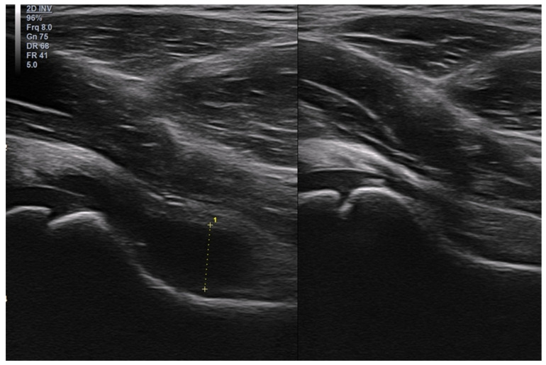 Figure 16