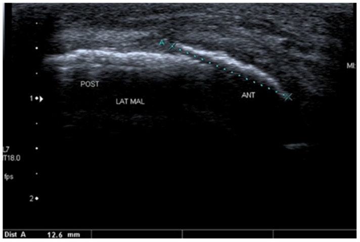 Figure 12