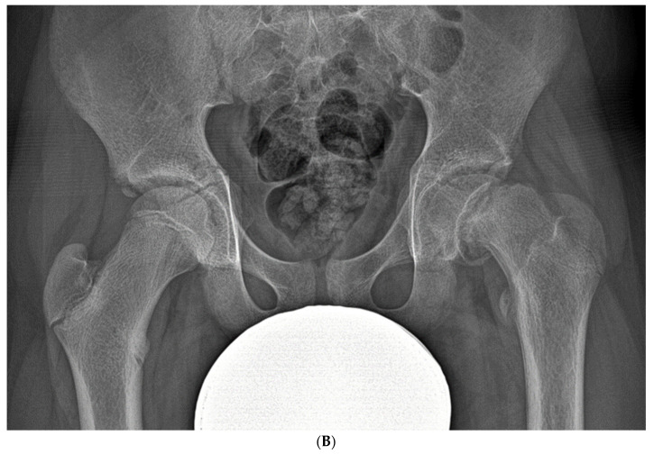Figure 14