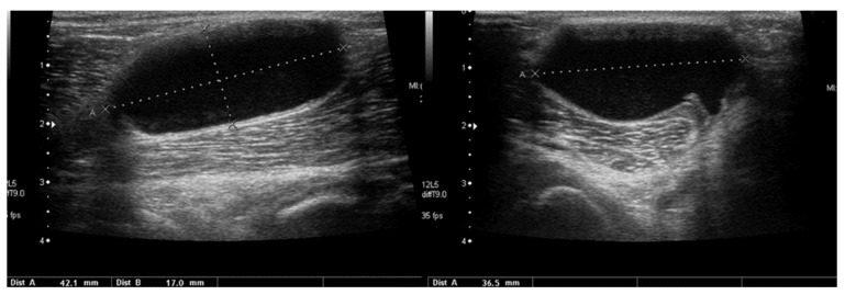 Figure 18