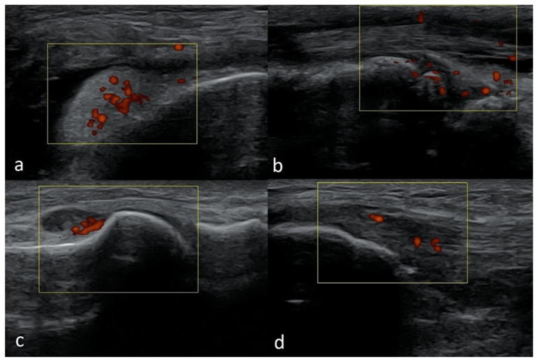 Figure 17