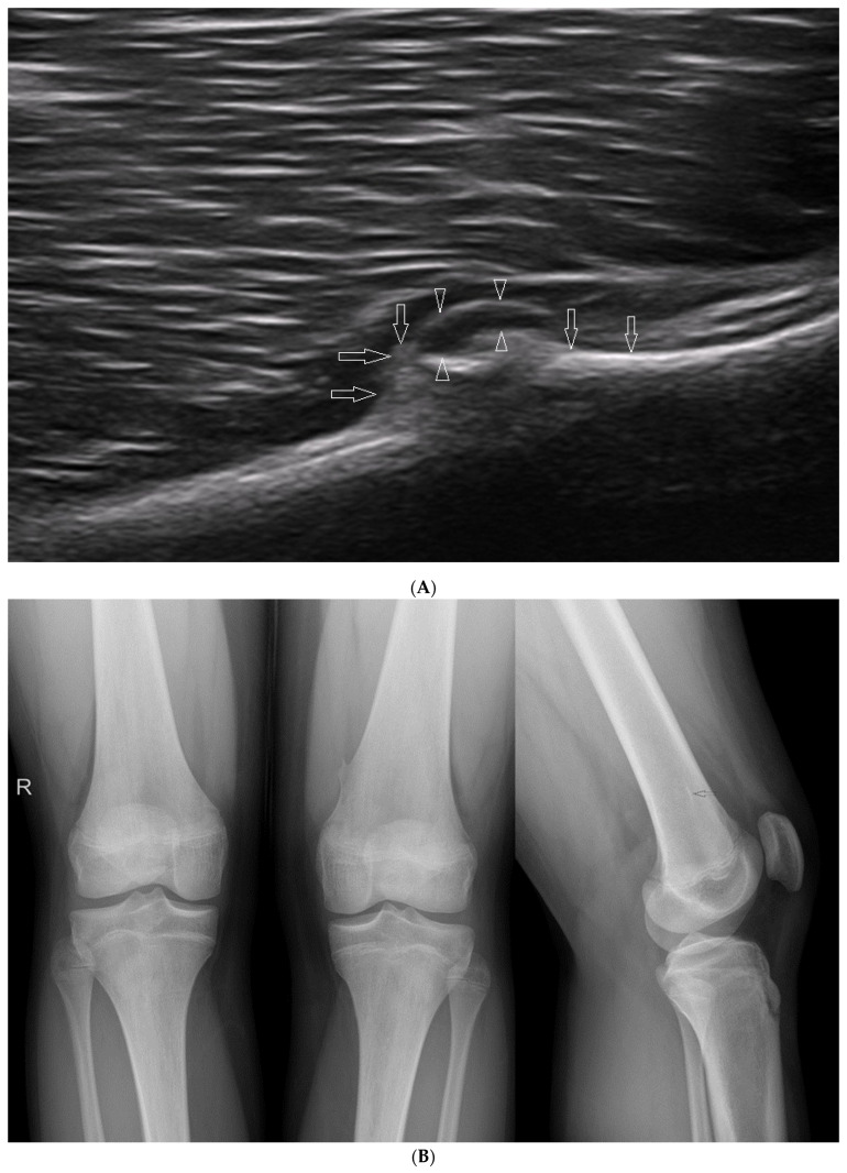 Figure 15
