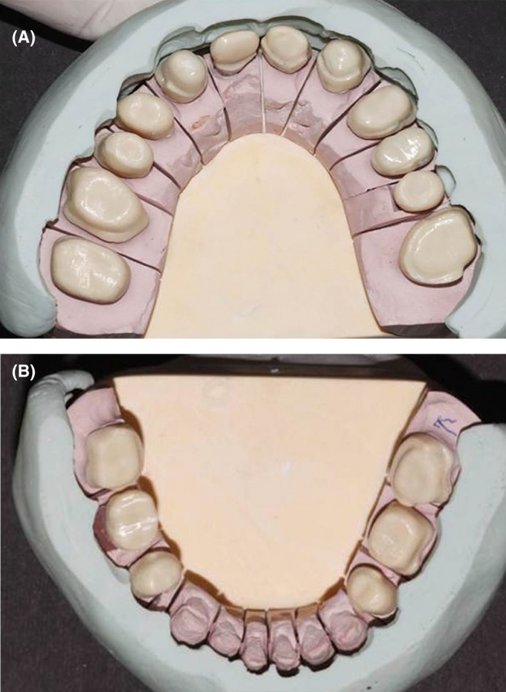 Figure 11