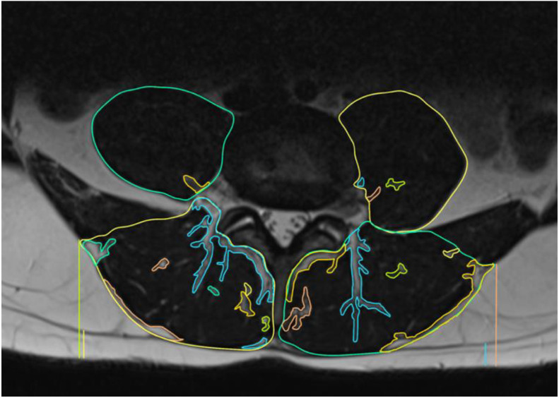 Fig 2: