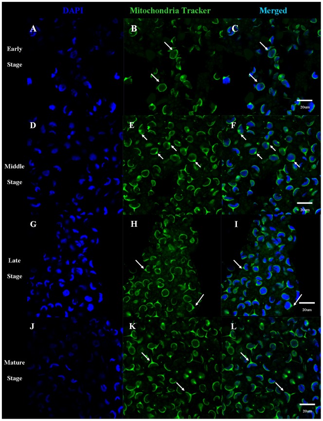 Figure 14