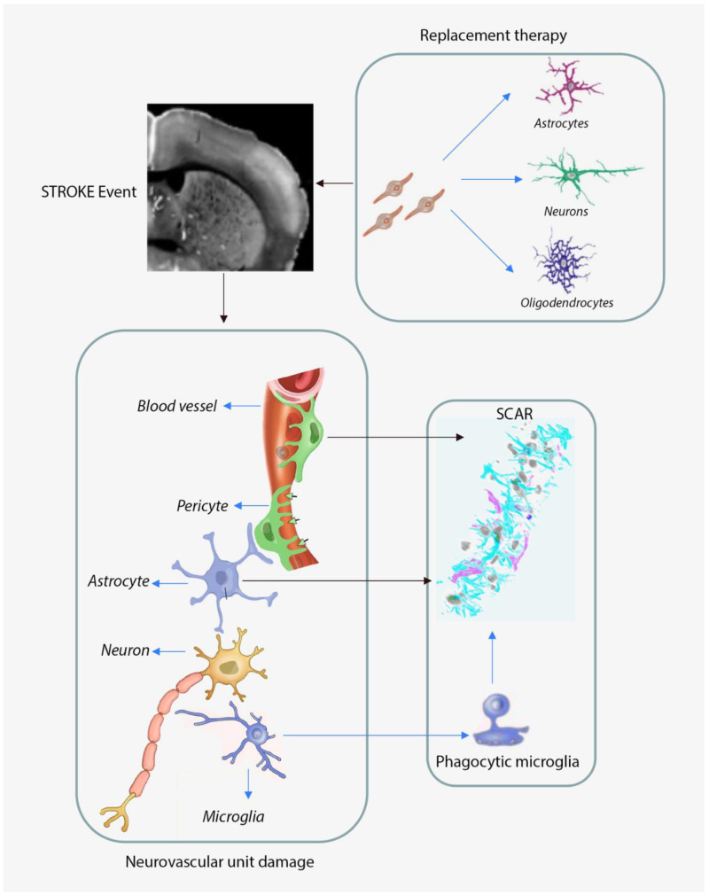 The Need for New Biomarkers to Assist with Stroke Prevention and Prediction of PostStroke