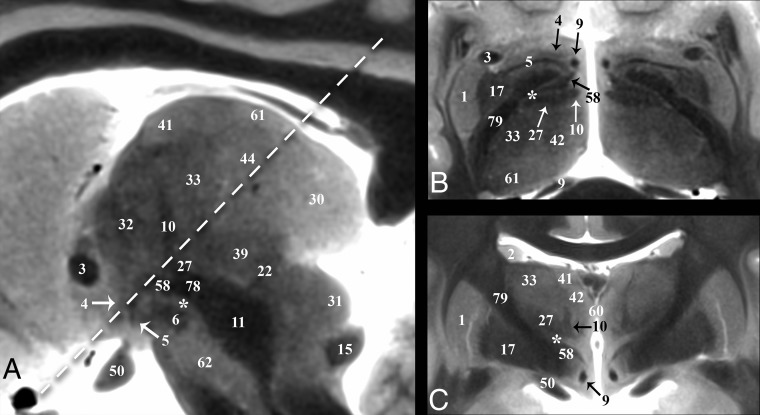 Fig 5.