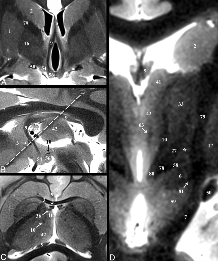 Fig 4.