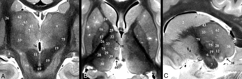 Fig 6.