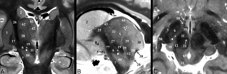 Fig 3.