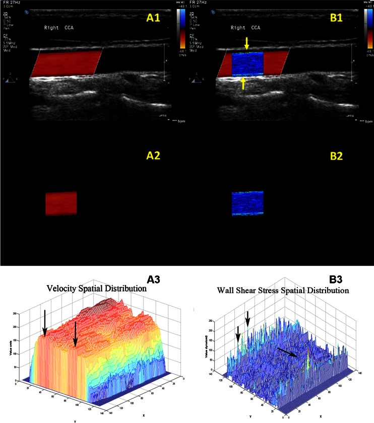 Fig. 2