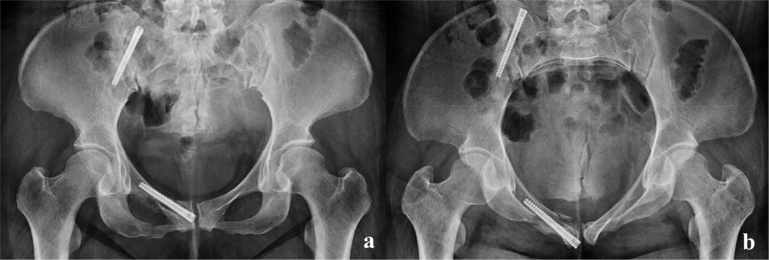 Fig. 5