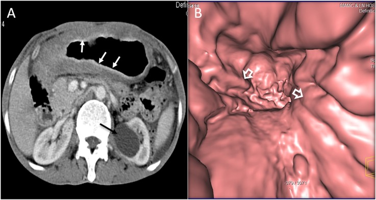 Figure 6.