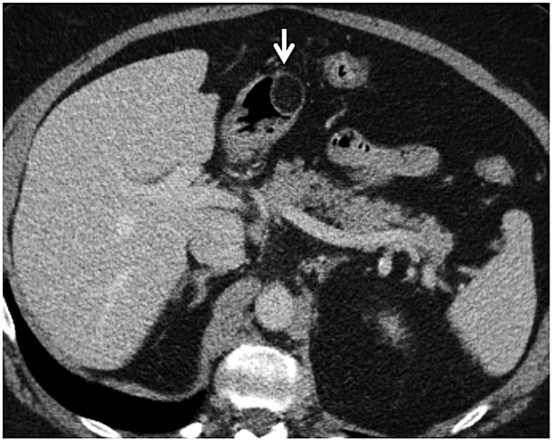 Figure 12.