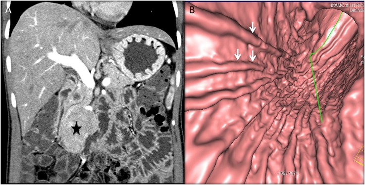 Figure 14.