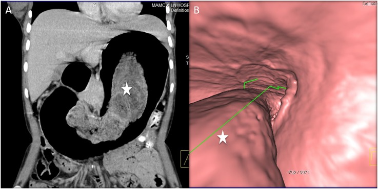 Figure 15.
