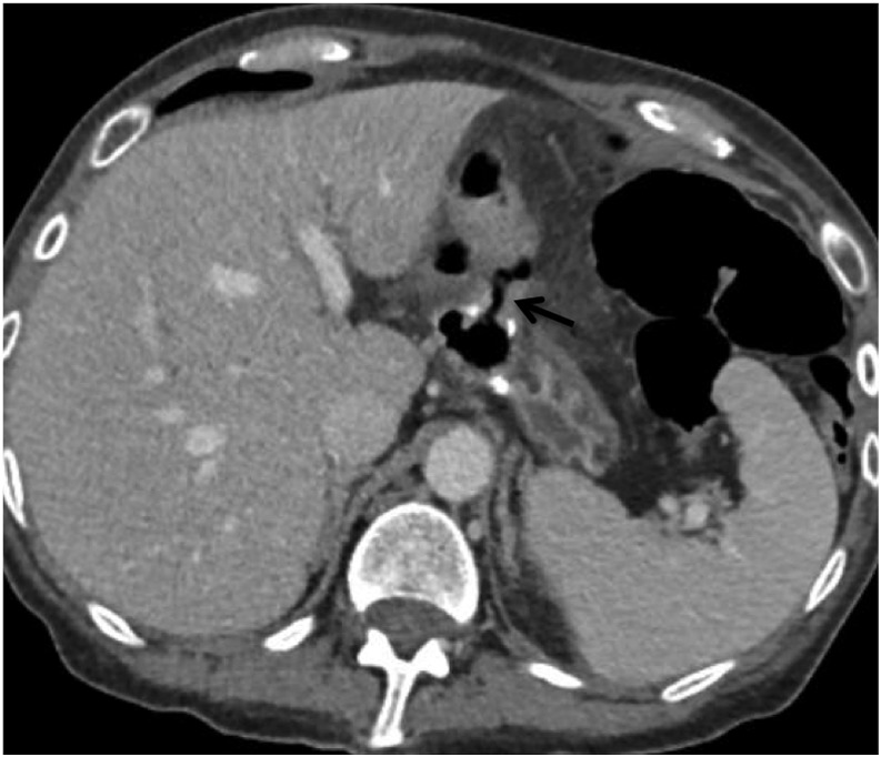 Figure 17.