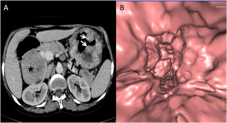 Figure 10.