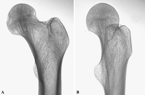 Fig. 1A–B