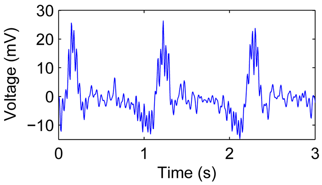 Fig. 16