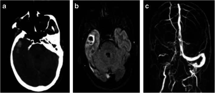 Fig. 2