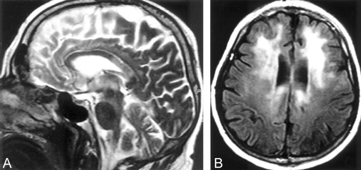 Fig 3.