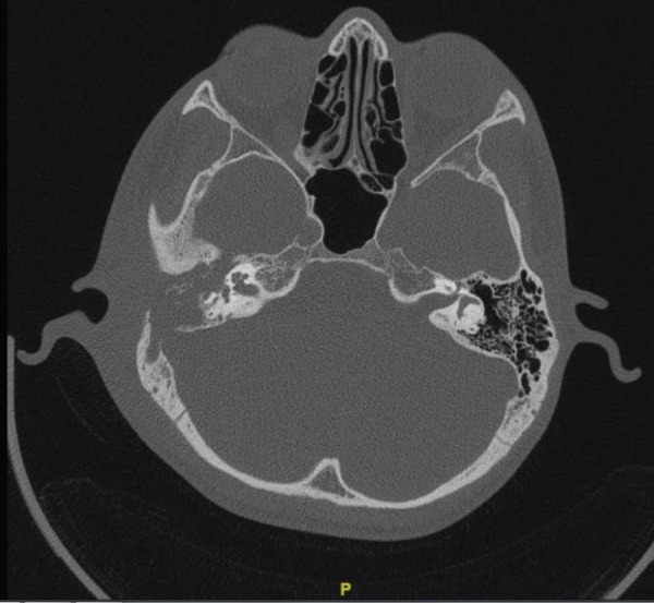 Fig. 1a (Left):