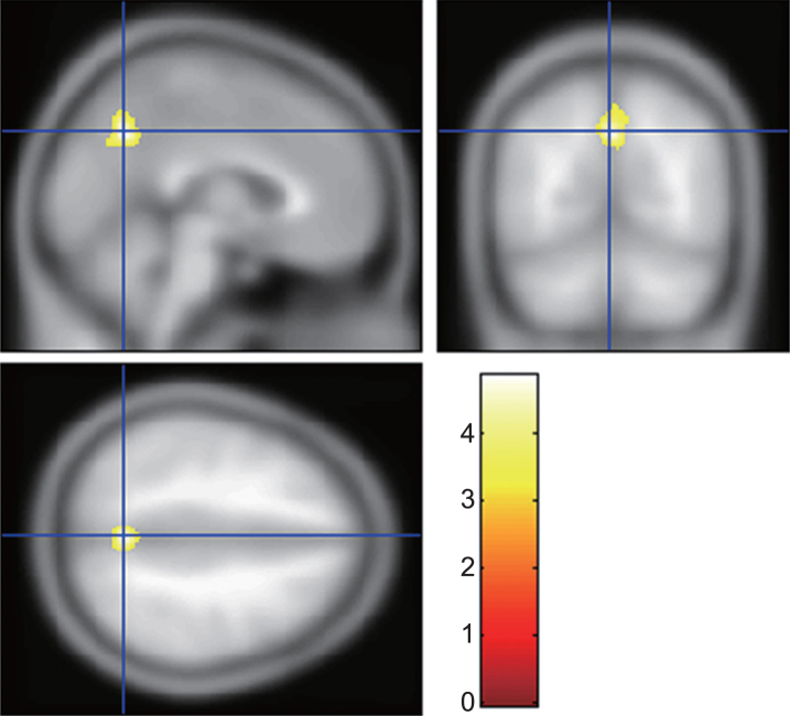 Fig.2