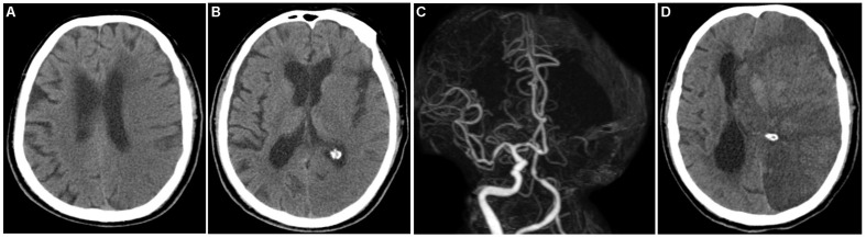 FIGURE 3