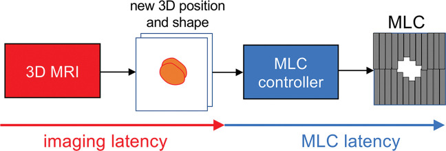 General idea for real-time three-dimensional MRI-guided intrafraction adaptive-to-shape treatment. A fast three-dimensional (3D) MRI technique will provide the volumetric position and shape of the target, which will be streamed to the multileaf collimator (MLC) controller. The MLC controller will adapt to the volumetric position and shape by moving the multiple leaves. The tracking latency (ie, the time from the start of image acquisition to the end of multileaf collimator movement) is provided by the sum of imaging latency (including acquisition, reconstruction, and segmentation) and multileaf collimator latency. Developments in fast three-dimensional MRI are aimed at minimizing the imaging latency for real-time three-dimensional adaptation.