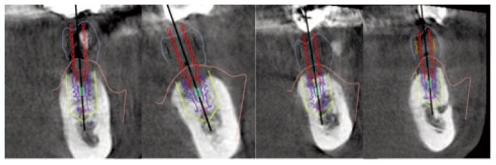 Figure 14