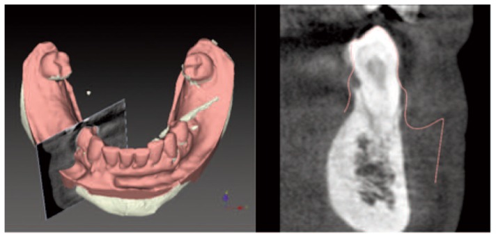 Figure 12