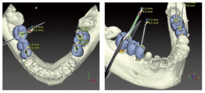 Figure 13