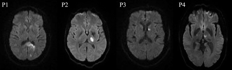 Fig.1