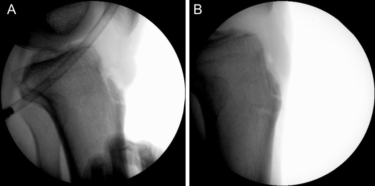 Figure 6. A, B.