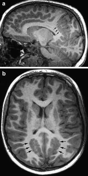 Fig. 11