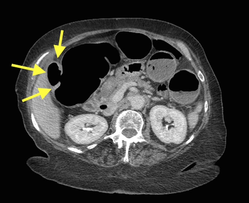 Figure 4