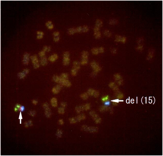 Fig. 2