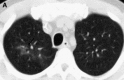 Fig. 28