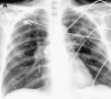 Fig. 23