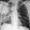 Fig. 27