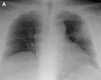 Fig. 30