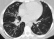 Fig. 24