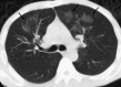 Fig. 11
