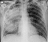 Fig. 26